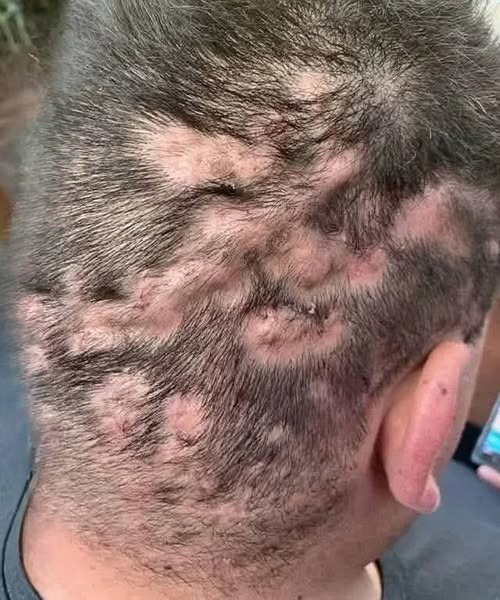 Recognizing Early Warning Signs: How to Identify Symptoms Before They Become Serious