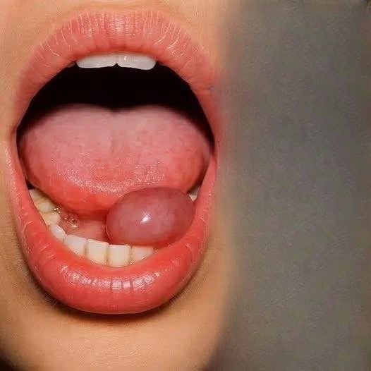 Understanding Oral Cancer — A Silent but Preventable Threat