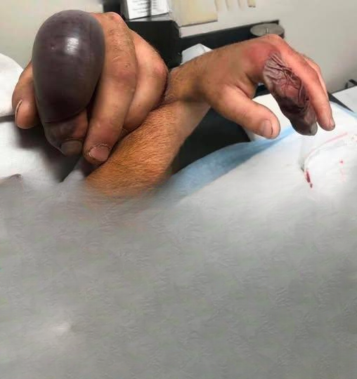 Unexpected Animal Encounters Reported in Bathrooms Across Various Regions