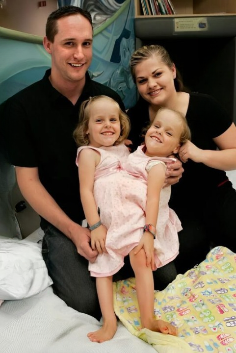 From Conjoined at Birth to Thriving at 19: The Remarkable Journey of Kendra and Maliah