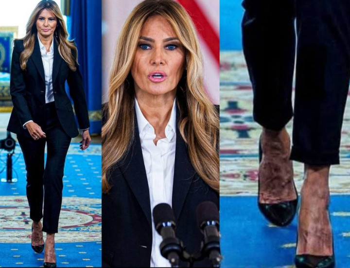 When Visible Veins Speak: What Your Body Might Be Trying to Tell You