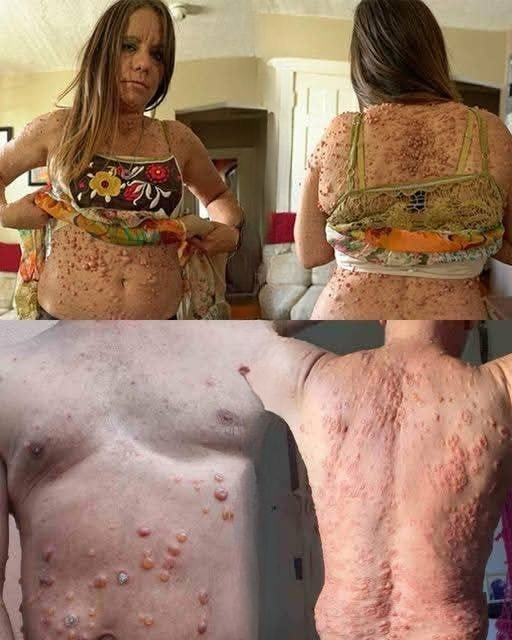 When Intimacy Leaves Scars: Understanding Emotional Impact, Healing, and Self-Worth