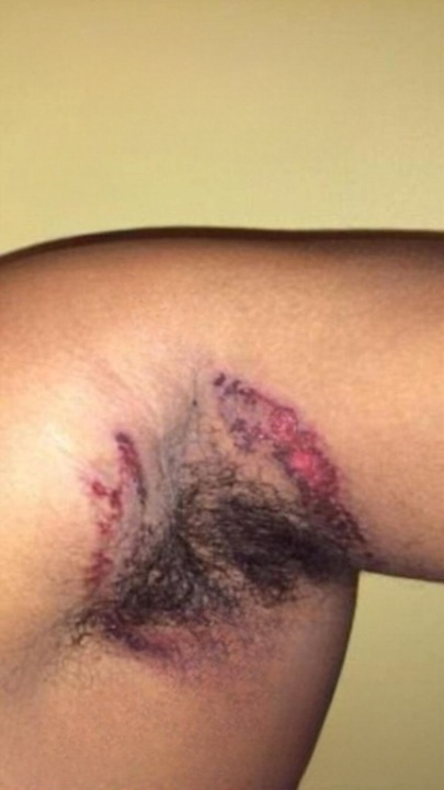 Yellow Skin: What It Reveals About Your Liver Health