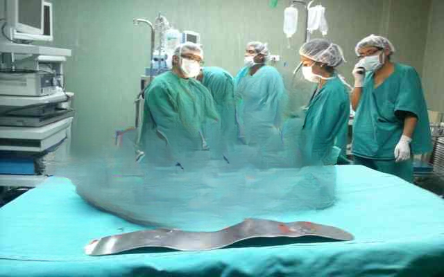 Miraculous Survival: Woman Faces Life-Threatening Tumor Mistaken for Triplets