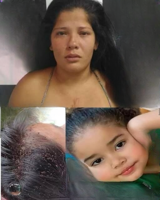 3-year-old girl after lice and mother warns…