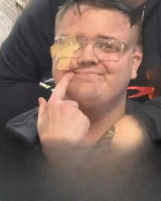 Man, 26, diagnosed with inoperable brain tumor opens up about the subtle early sign