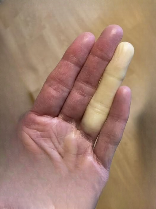 These are the consequences of sleeping with…