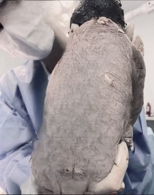 A Life That Refused To Be Stopped: The Remarkable Birth That Captured Global Attention