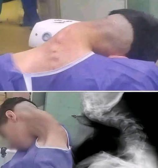 A Cautionary First Experience: A Story About Health, Awareness, and the Importance of Proper Education