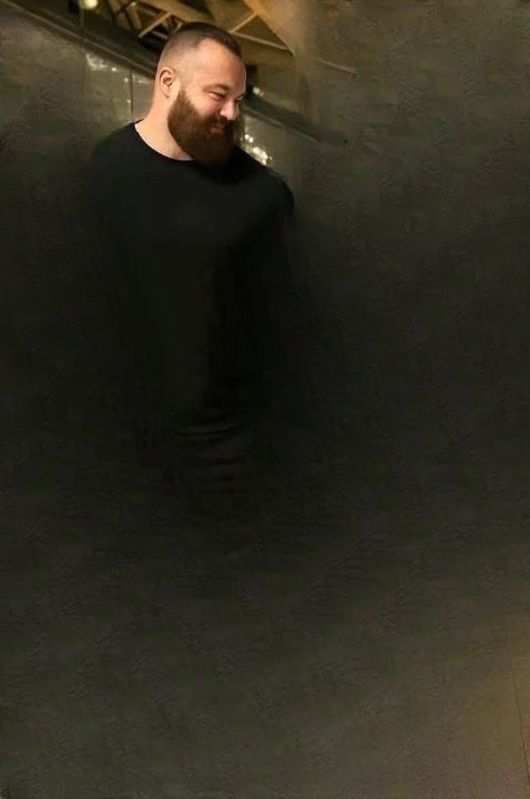 Young Woman Hospitalized After Serious First-Time Injury — A Call for Better Education