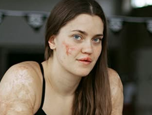 The Consequences of Ignoring Genital Health: A Comprehensive Guide