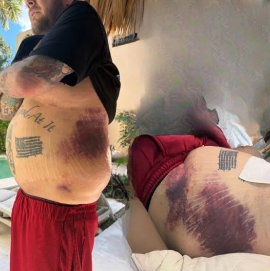 A Difficult Chapter: Corey Harrison Faces Recovery, Financial Strain, and Public Support
