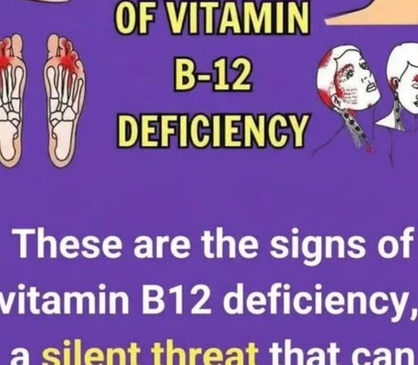 Common Signs and Symptoms of Vitamin B12 Deficiency