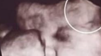 Mother Feared the Worst After Seeing Her Daughter’s Ultrasound — But the Truth Brought Relief