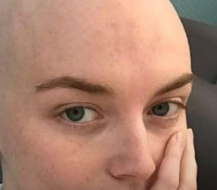 A Woman Shares Three Warning Signs She Ignored Before Receiving a Stage 4 Diagnosis