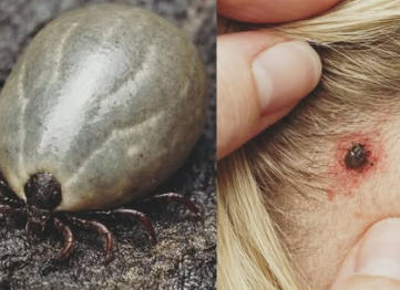 Found a Weird Bug in Your Child’s Hair? Important Info for Parents