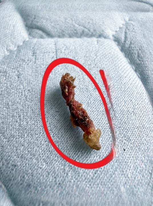 Terrifying Bedtime “Parasite” Turns Out to Be Something Far More Ordinary After Family Panic Unfolds