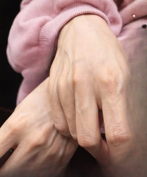Why Veins Sometimes Become More Visible: Causes, Symptoms, and Simple Care Tips