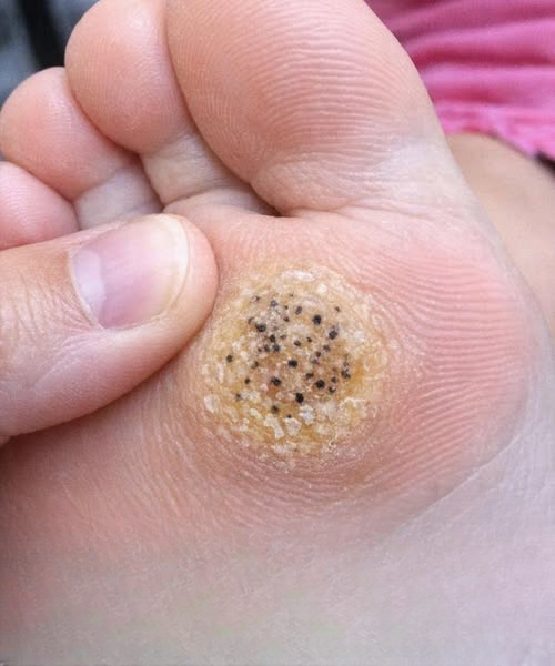 A Parent’s Guide to Handling Foot Pain Before a Big Performance