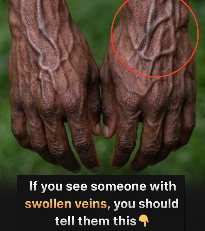 The Hidden Clues in Your Hands: What Your Veins May (and May Not) Say About Your Health
