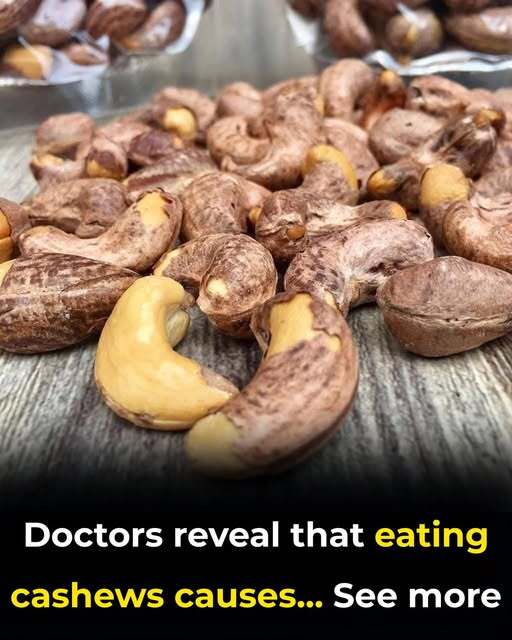 Doctors Reveal What Really Happens When You Eat Cashews