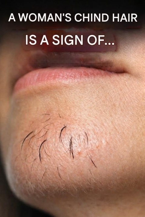 Why Chin Hair Appears in Women—and What It Can Reveal About the Body