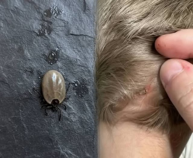 The Little Scalp Intruder: A Complete Guide for Parents