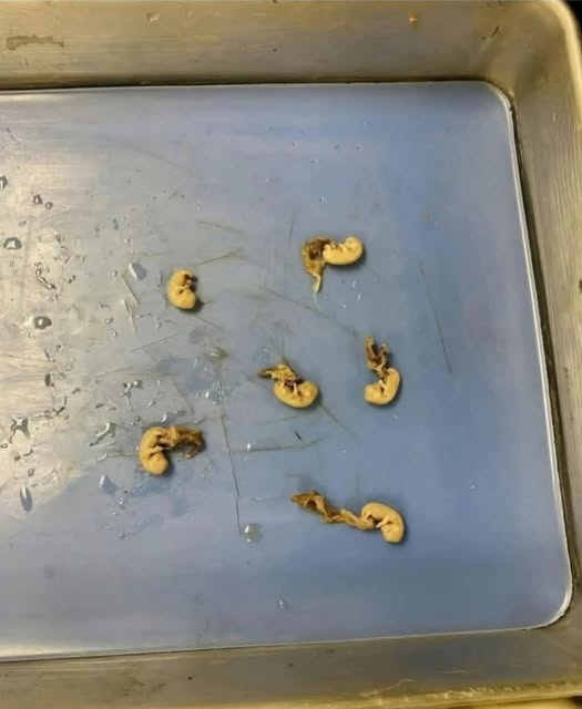 Beware the “Seeds in Your Snack”: How Hidden Threats Can Lurk in Everyday Foods