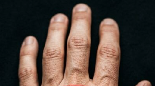 If Your Veins Are Visible: What It Really Means for Your Body