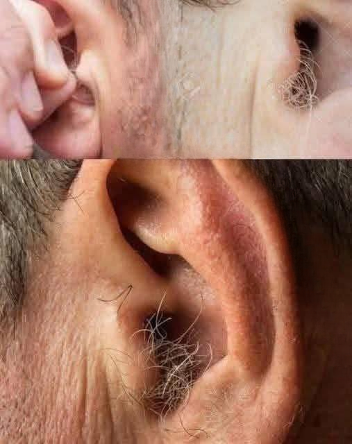 Why Are My Ears Hairy? Understanding What’s Normal and Why It Happens