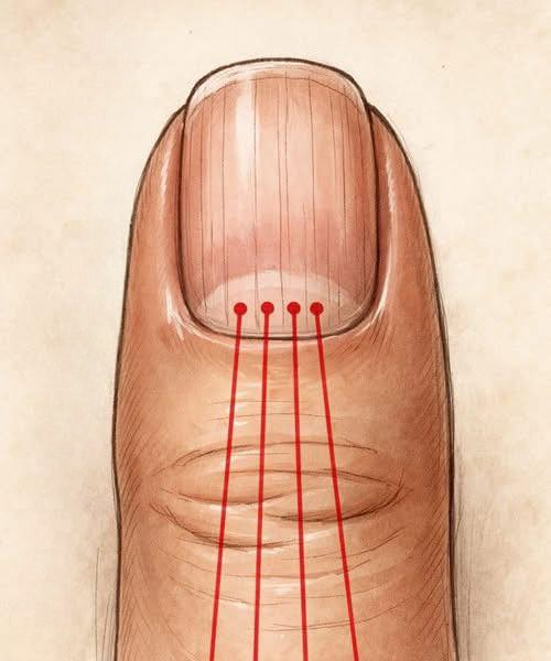 If You Have Lines on Your Nails, Here’s What They Really Mean