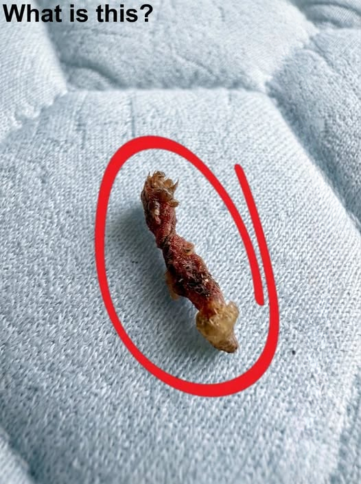 I Woke Up Thinking Something Was Biting Me—But the Truth Was Completely Unexpected