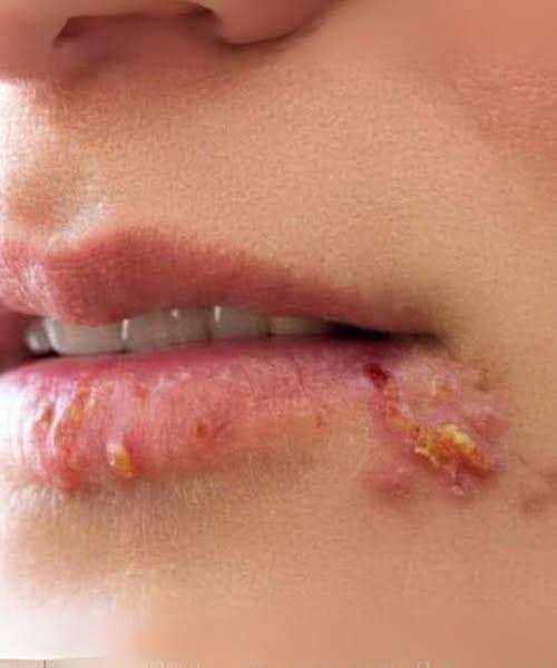 These Are the First Symptoms You Should Never Ignore