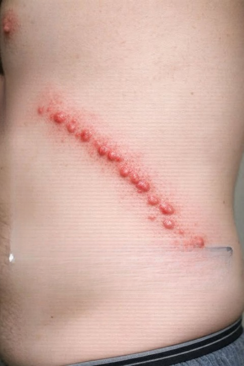 Red, Itchy Bumps in Lines on the Skin: Common Causes, What to Look For, and When to Seek Help