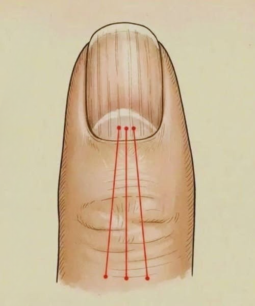 What to Eat to Support Healthier Nails: A Nutrition Guide for Reducing Nail Ridges