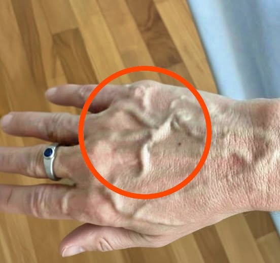 What Visible Veins Could Mean: Normal Changes vs. Signs You Shouldn’t Ignore