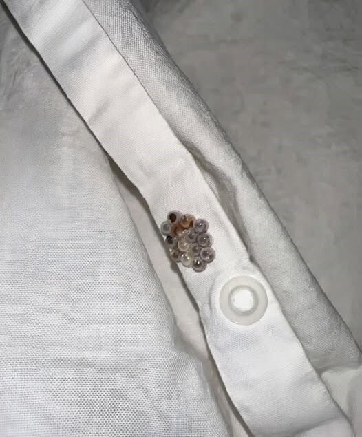 I Found Tiny Balls in My Bed and Nearly Had a Heart Attack — Here’s What They Really Were