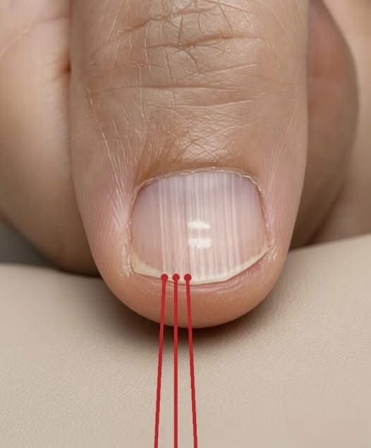 If You Notice Lines on Your Nails, It Might Be Worth a Closer Look