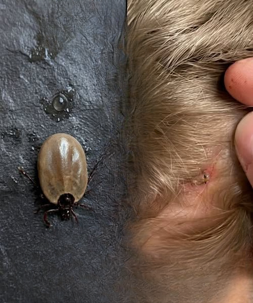 What to Do If You Find Ticks in Your Child’s Hair (Without Panicking)