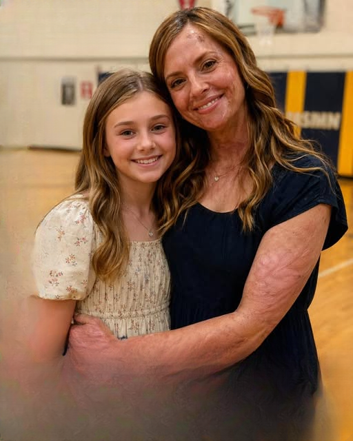 My Daughter Begged Me Not to Come to Her School Because of My Scarred Face — Then a Stranger Revealed a Truth I Had Hidden for 20 Years