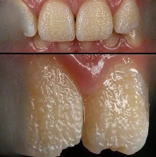 What Your Teeth May Be Telling You: Daily Habits, Hidden Causes, and a Rare Genetic Condition
