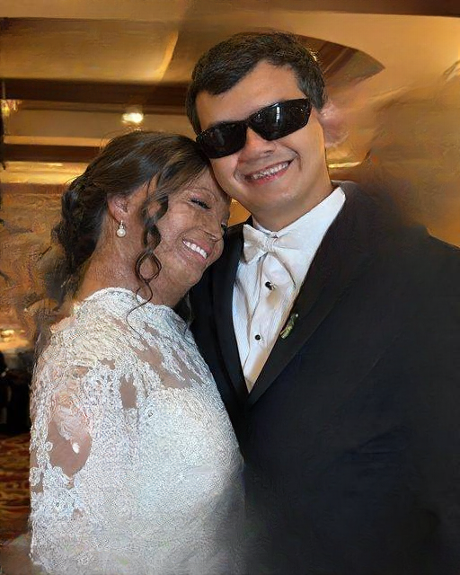 I Married a Blind Man Believing He’d Never Judge My Scars — Then He Revealed a Secret He Had Hidden for 20 Years