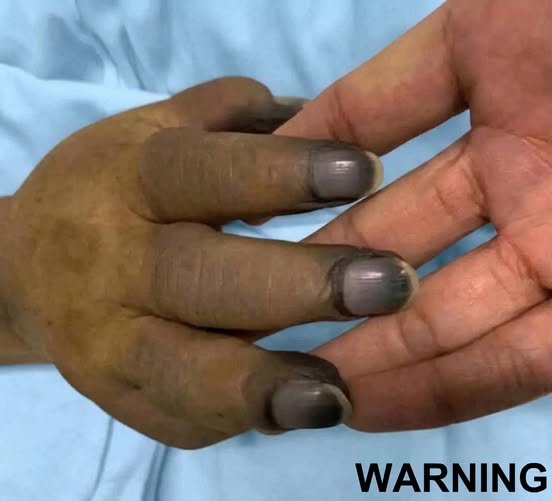 The Hidden Damage Certain Nail Products Can Cause Over Time