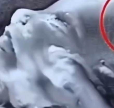 Doctors Noticed Something Unusual During a Routine Ultrasound — and the Surprise Continued After Birth