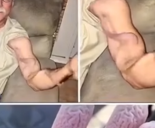 Sudden Arm Cramp During a Stretch? Here’s What Your Body May Be Trying to Tell You