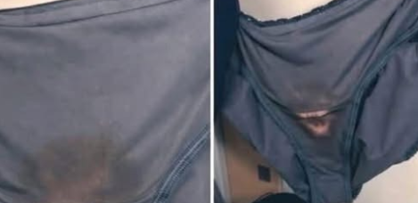 BE CAREFUL, If You Notice This in Your Underwear, Here’s What Experts Say It Usually Means