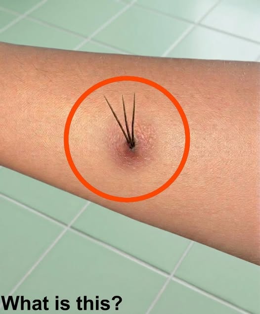 A Terrifying Discovery After a Forest Hike Turned Out to Be Something Much Simpler Than Expected