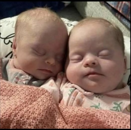 Mother of Rare Identical Twins With Down syndrome Inspires Thousands With Message of Love and Acceptance