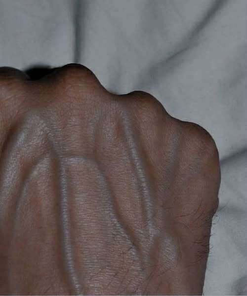 What Visible Veins Usually Mean — And When You Should Pay Attention