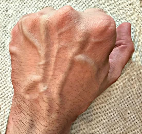 If Veins Are Becoming More Visible on Your Hands, Your Body Could Be Trying to Tell You Something